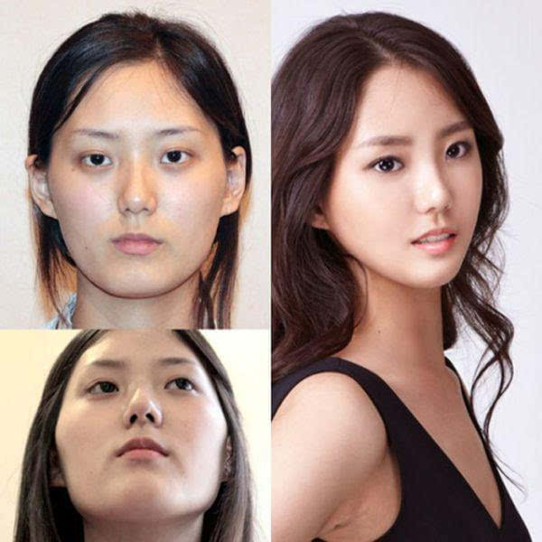 整容臉型圖片大全，探索各種美麗臉型與整容技巧，整容臉型圖片大全，探索美麗臉型與整容秘籍