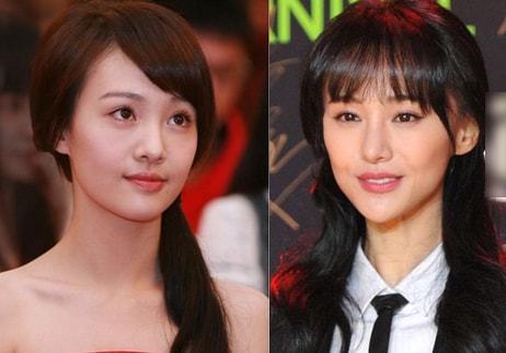 明星都整過(guò)容嗎？揭秘娛樂(lè)圈的真實(shí)情況，揭秘娛樂(lè)圈，明星們是否都經(jīng)歷過(guò)整容？
