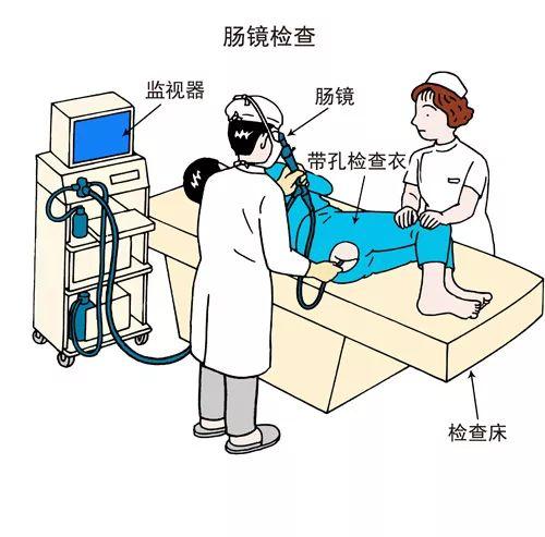 做胃鏡檢查前需要做的準備工作，胃鏡檢查前的準備工作須知