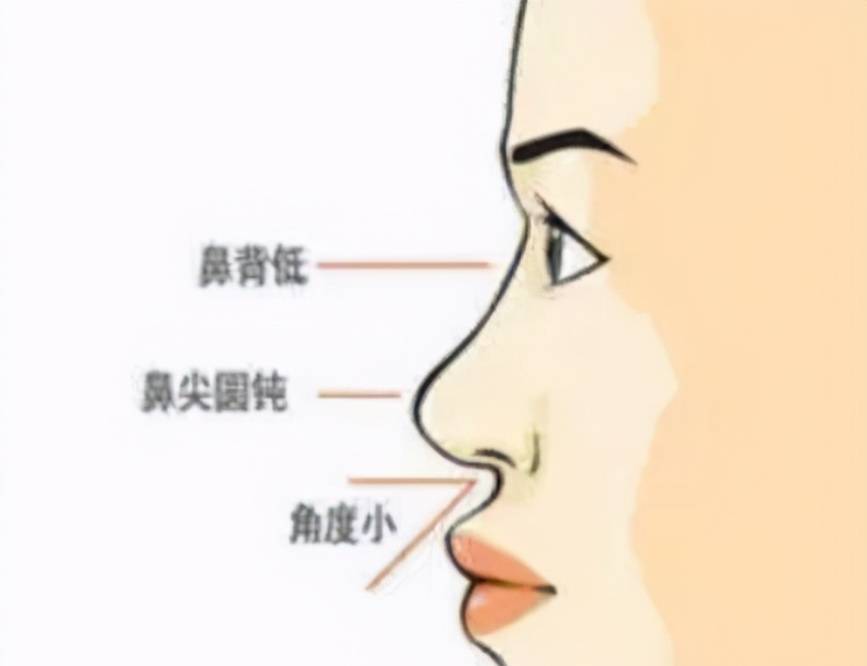鼻梁幾歲定型，關(guān)于鼻梁發(fā)育的全方位解析，鼻梁發(fā)育全解析，鼻梁定型年齡及發(fā)育過程探討