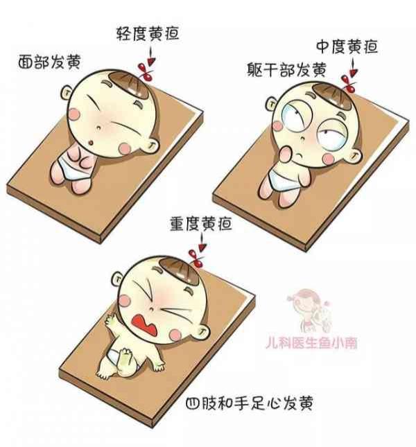 新生兒黃疸，了解、預(yù)防與治療，新生兒黃疸，全面解析黃疸的預(yù)防與治療方法