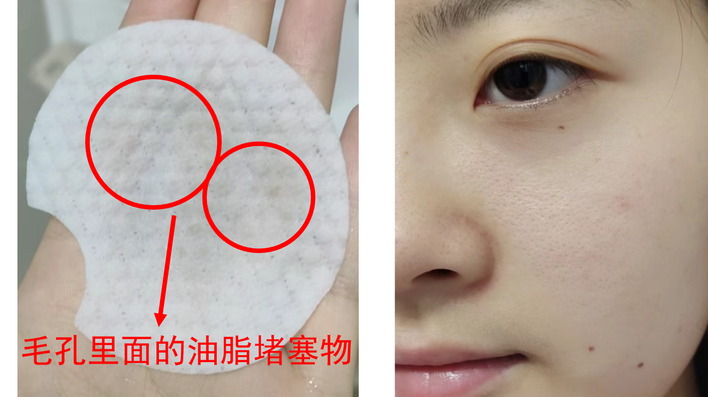 毛孔粗大怎么修復(fù)最有效，全面解析有效解決方案，毛孔粗大全面修復(fù)攻略，最有效的解決方案解析