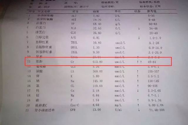 肌酐多少是尿毒癥？全面解析肌酐與尿毒癥的關(guān)系，肌酐與尿毒癥深度解析，數(shù)值界限與關(guān)系探討