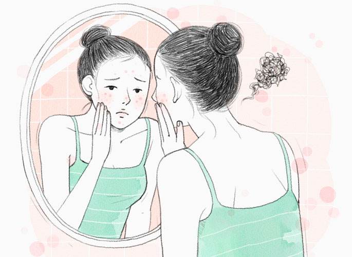 激光痘印治療，你需要知道關(guān)于激光痘印治療次數(shù)的一切，激光痘印治療詳解，治療次數(shù)與效果解析