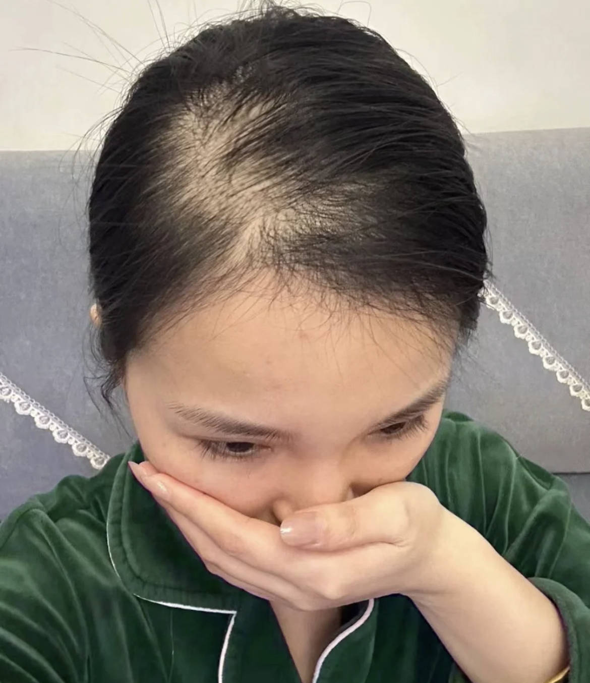頭發(fā)量暴增的五個方法，全方位解析頭發(fā)健康與增長秘籍，全方位解析，頭發(fā)增長秘籍，五個方法助你頭發(fā)量暴增！
