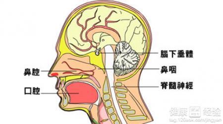 鼻咽癌早期的五大癥狀及其識別重要性，鼻咽癌早期五大癥狀及識別重要性指南