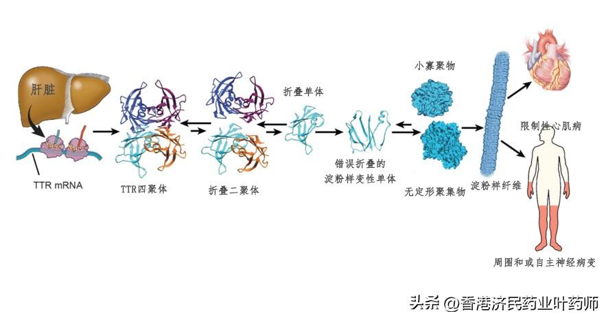 神經(jīng)衰弱吃什么藥，藥物治療與輔助措施，神經(jīng)衰弱藥物治療指南，藥物選擇與輔助措施