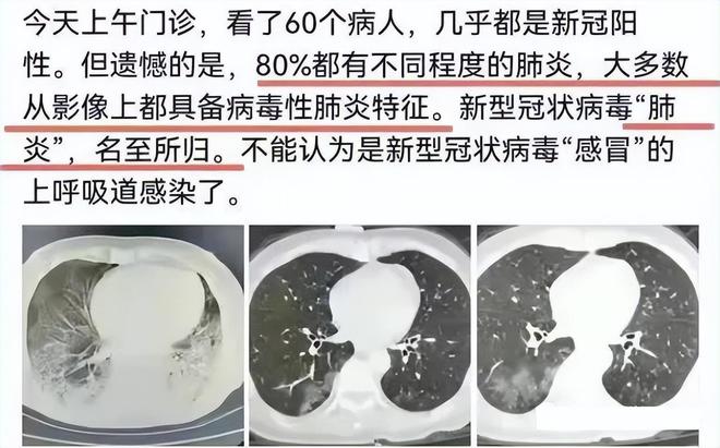 白肺的早期癥狀及其識別與防治，白肺早期癥狀識別與防治攻略