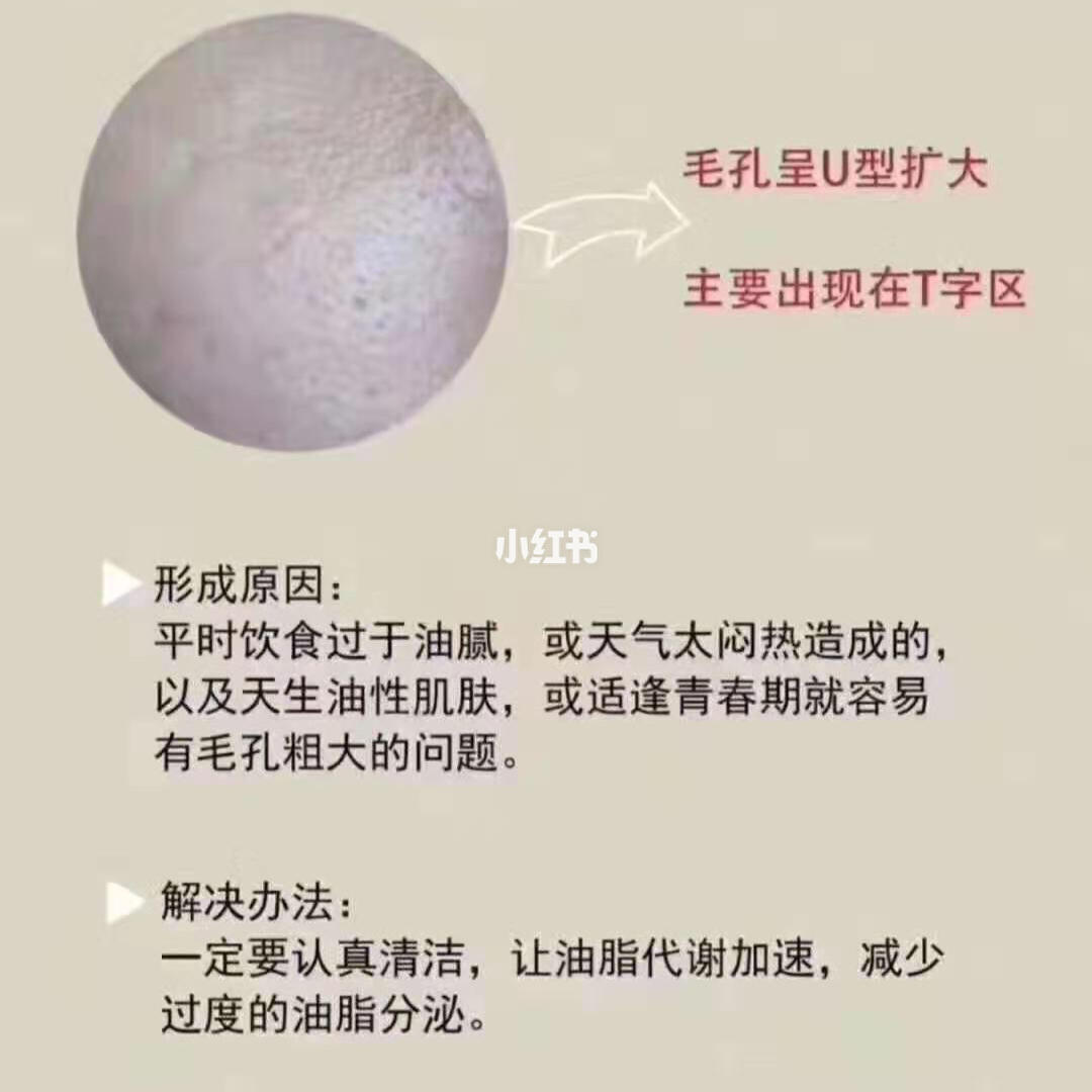 毛孔粗大的原因及其解決方法，毛孔粗大的成因與解決方案