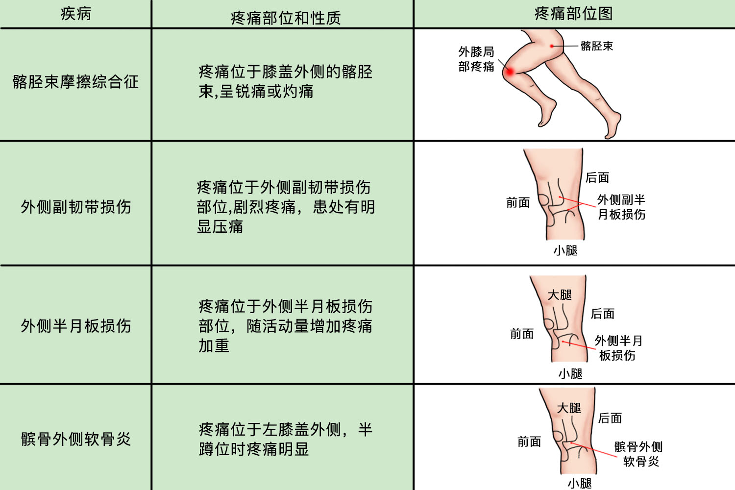 膝蓋疼痛部位對(duì)照表，診斷與治療的重要性，膝蓋疼痛部位對(duì)照表，診斷與治療的重要性解析