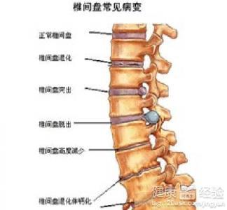 頸椎病的癥狀解析，了解、預(yù)防與應(yīng)對(duì)，頸椎病癥狀解析，了解預(yù)防與應(yīng)對(duì)策略