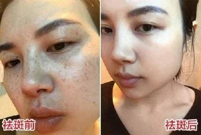 十大美白祛斑排行榜，帶你了解最有效的美白祛斑產(chǎn)品，十大美白祛斑產(chǎn)品排行榜，帶你探索最有效果的美白祛斑神器