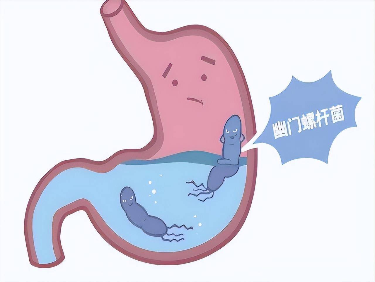 女性感染幽門(mén)螺桿菌的癥狀及應(yīng)對(duì)之策，女性感染幽門(mén)螺桿菌的癥狀與應(yīng)對(duì)策略