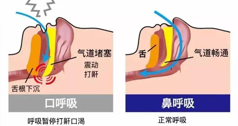 打呼嚕的原因及其影響因素，深度解析，深度解析，打呼嚕的原因及其影響因素