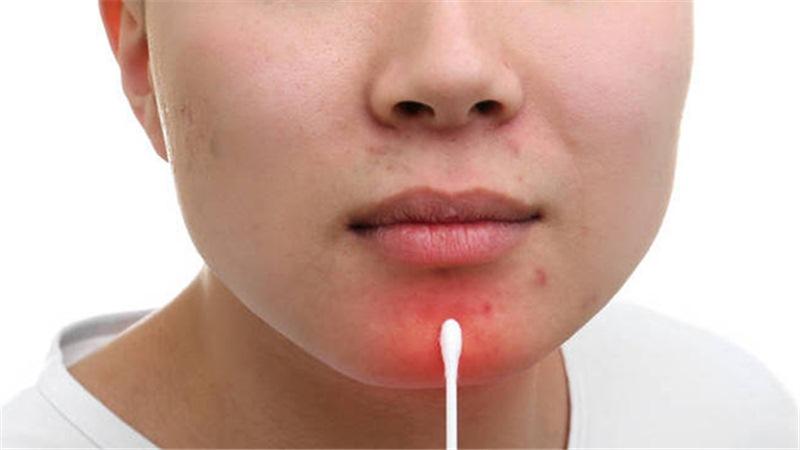 去醫(yī)院看痘痘需要多少錢？一文解析費(fèi)用因素，解析看痘痘費(fèi)用，一文了解治療痘痘需要多少錢？