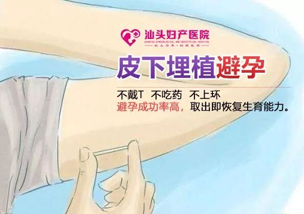 皮埋避孕