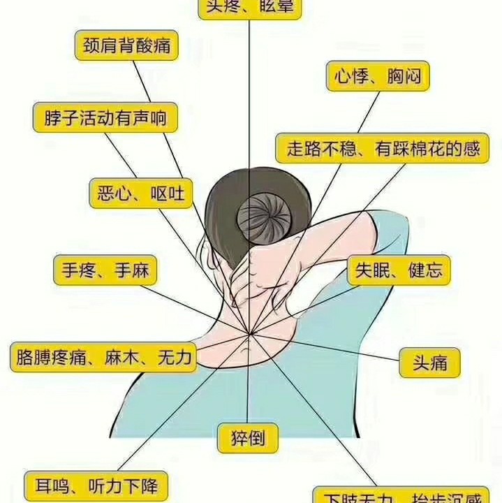 如何判斷自己是否患有頸椎病，癥狀與自我檢查方法，如何判斷自己是否患有頸椎病，癥狀及自我檢查攻略