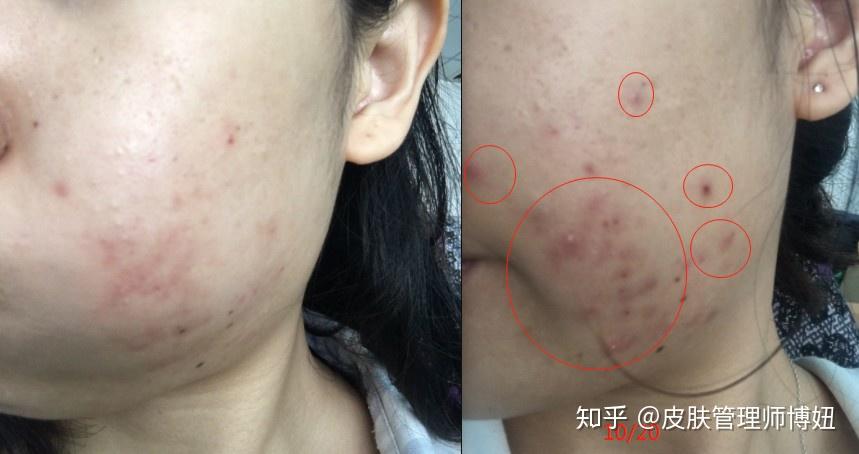 重塑肌膚光彩