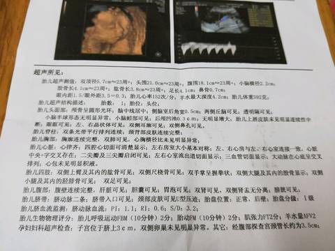 四維單子3秒鐘看男是女，揭秘最新科技下的胎兒性別鑒定技術(shù)，最新科技揭秘，3秒四維彩超鑒定胎兒性別