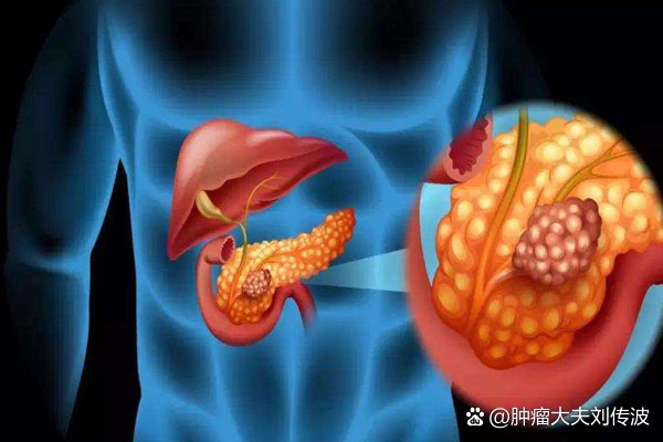 預(yù)防與應(yīng)對策略