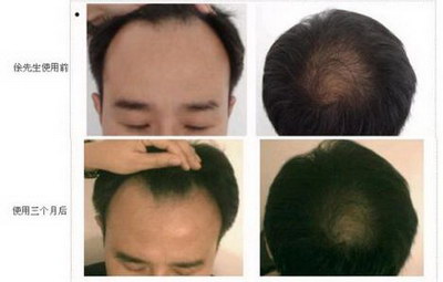 全方位解析與應(yīng)對方案