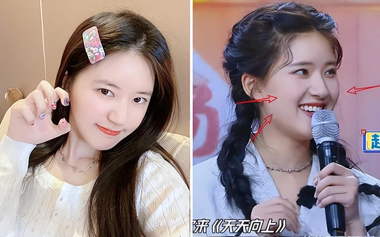 縮小鼻孔的七個(gè)實(shí)用方法——全方位指南，全方位指南，縮小鼻孔的七個(gè)實(shí)用方法