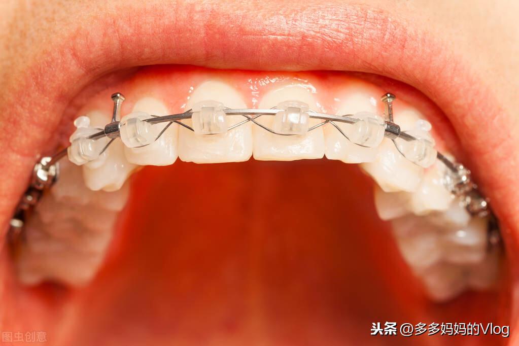 熱點(diǎn) 第191頁(yè)