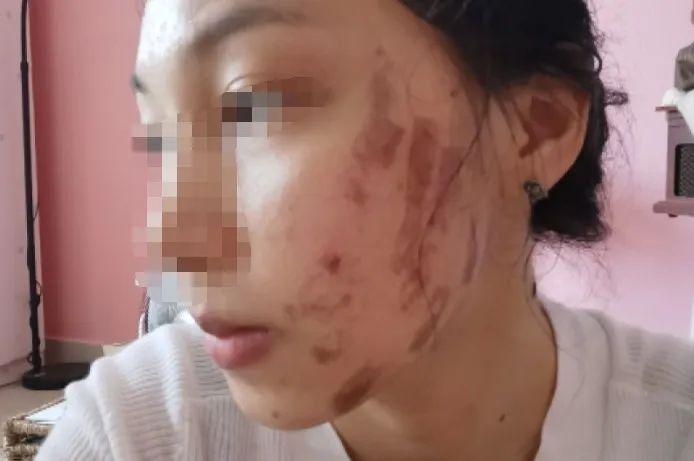 光子嫩膚與衰老，真相揭秘，你老得快嗎？，揭秘光子嫩膚與衰老真相，你了解衰老背后的秘密嗎？