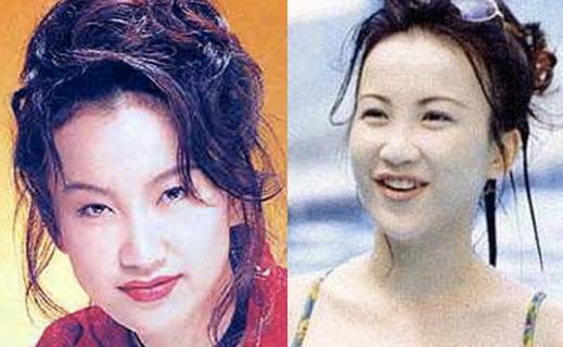 整容后的女明星們，變化背后的故事，女明星整容背后的故事揭秘