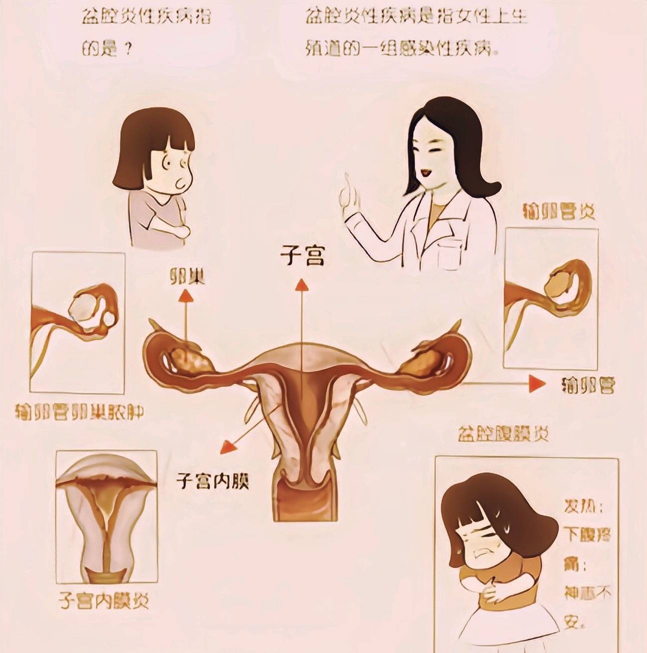 婦科炎癥，了解、預(yù)防與治療，婦科炎癥，全面解析預(yù)防與治療方法