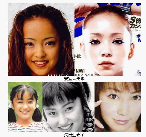 揭秘12位女星的整容前后，美麗背后的故事，揭秘女星整容前后，美麗背后的故事（附12位女星整容經(jīng)歷）