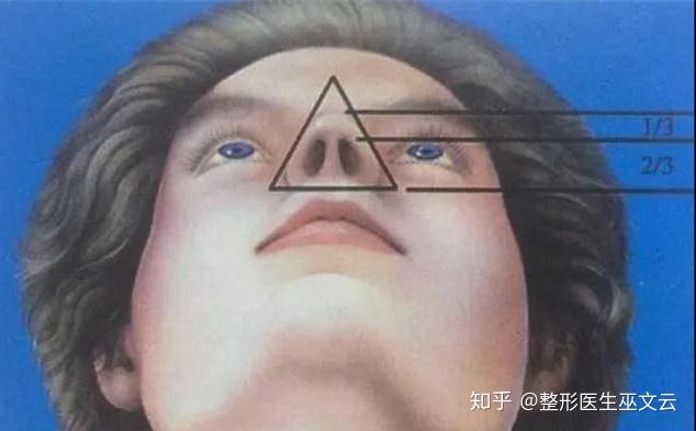 鼻翼縮小手術(shù)，改善鼻部外觀的專業(yè)方法，鼻翼縮小手術(shù)，專業(yè)改善鼻部外觀的方法